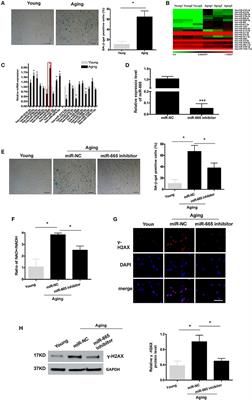 MiR-665 Regulates Vascular Smooth Muscle Cell Senescence by Interacting With LncRNA GAS5/SDC1